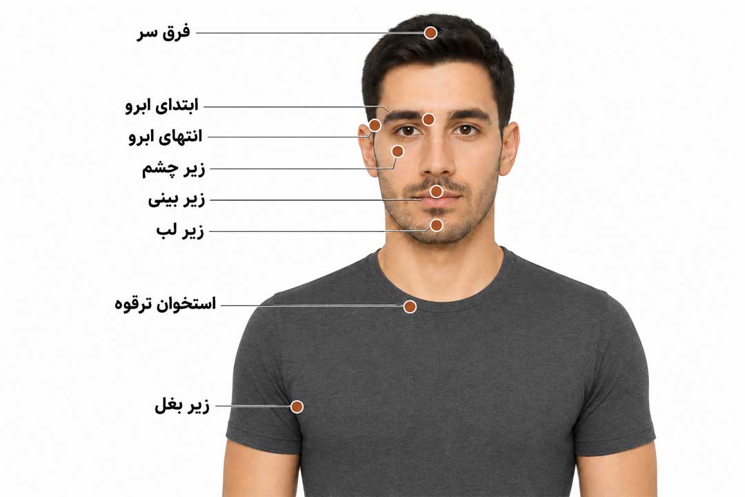 انجام ضربات ای اف تی روی نقاط مریدین
